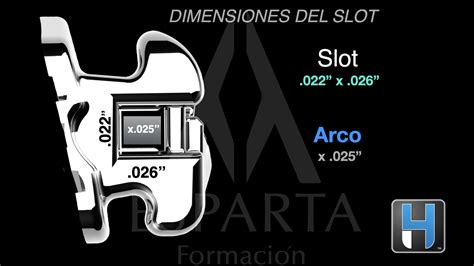 Arco Slots