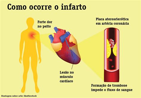 Jogo De Ataques De Coracao