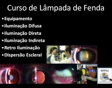 Lena Iluminacao De Fenda T5