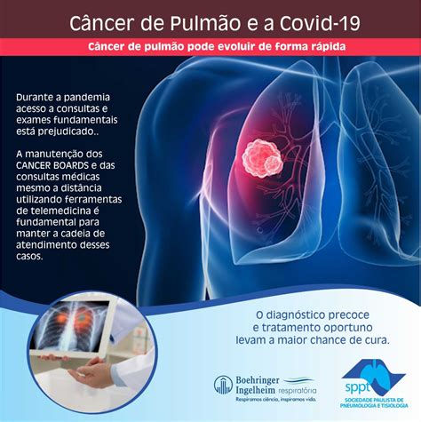 O Cancer De Pulmao Casino